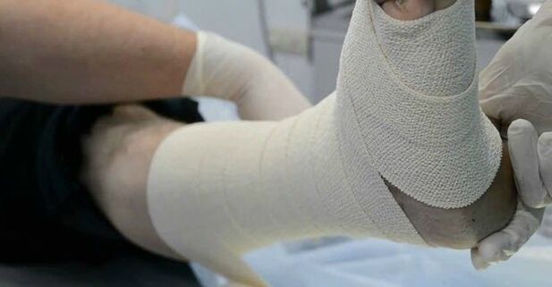 Bandage elastica