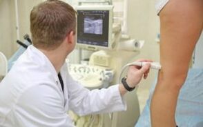 Metodi per il trattamento delle vene varicose sulle gambe nelle donne